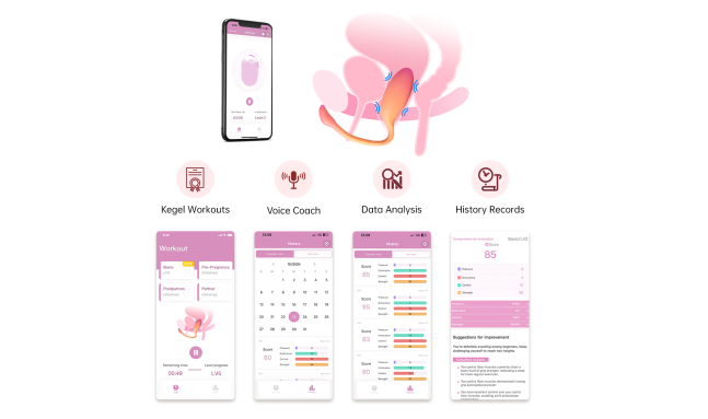 Magic Kegel app screens and a pelvic floor illustration.
